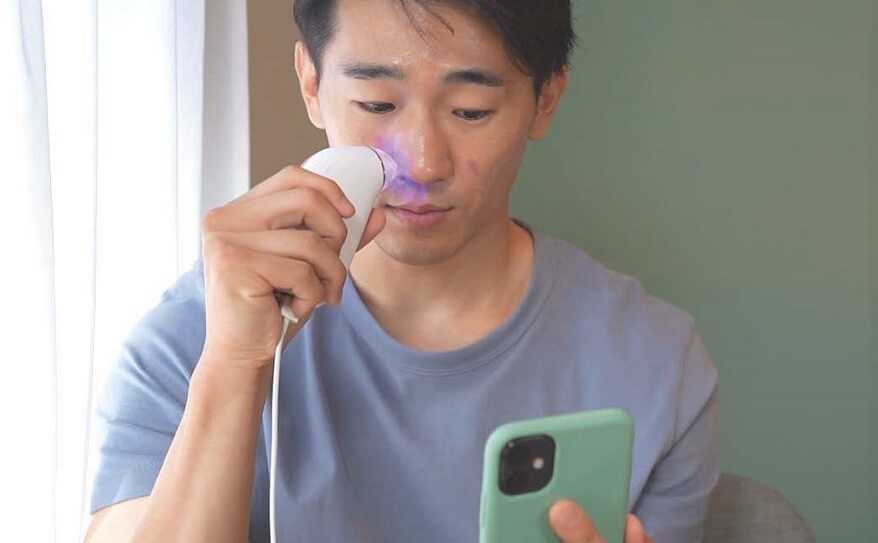 いちご鼻、小鼻の角栓除去に毛穴吸引器が大活躍！