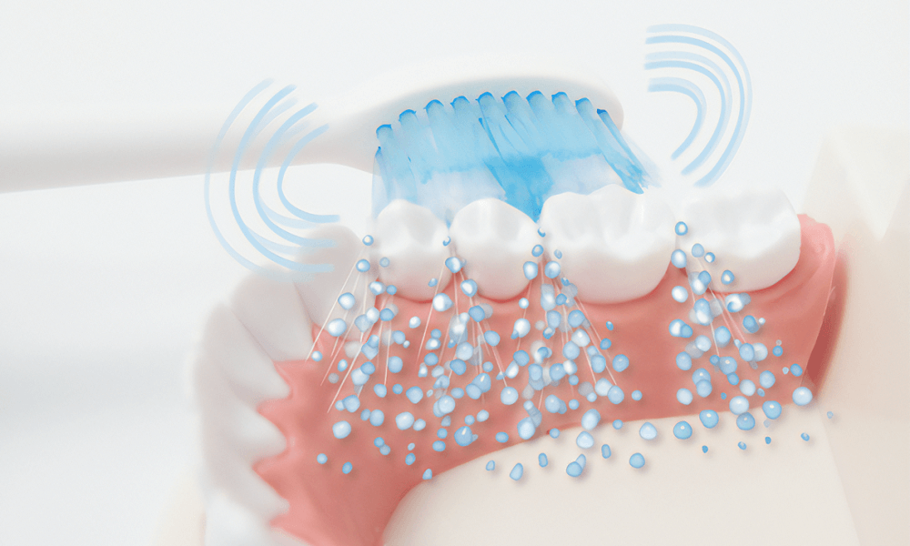 アレティの音波式電動歯ブラシは高速振動で歯の汚れを除去。2段階のスピード調整で歯ぐきに優しいケアが可能。